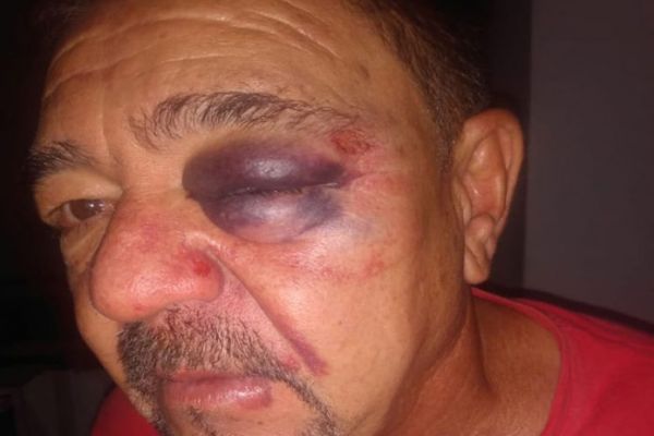 Rio do Pires: Servidor público é agredido na secretaria de saúde por colega após discussão sobre Bol