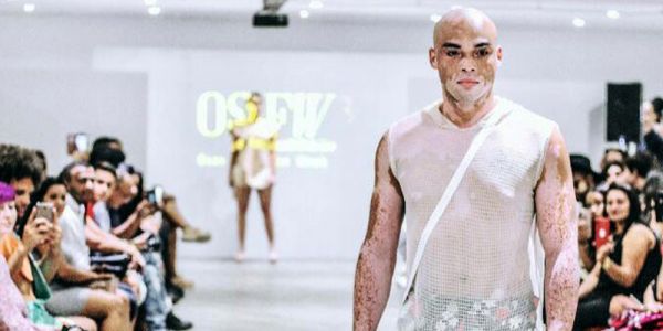 Portador de vitiligo, caculeense é destaque em desfile no Osasco Fashion Week, em São Paulo