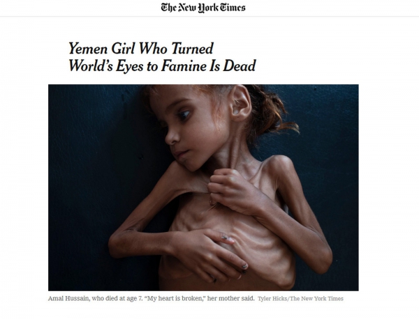 Morre menina símbolo da fome causada por guerra no Iêmen